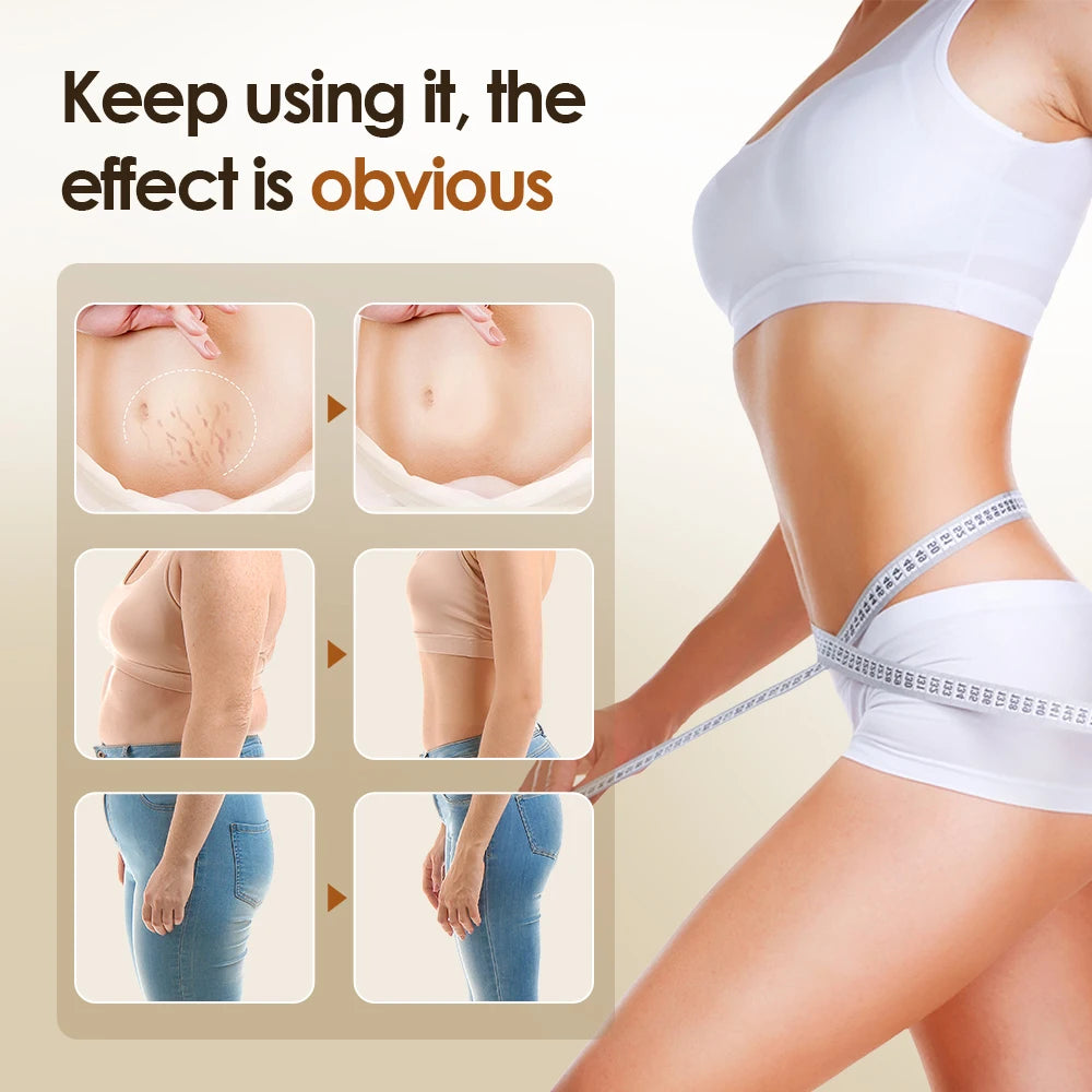 EMS Body Slimming Massager – Electric Fat Reduction & Body Shaping Device