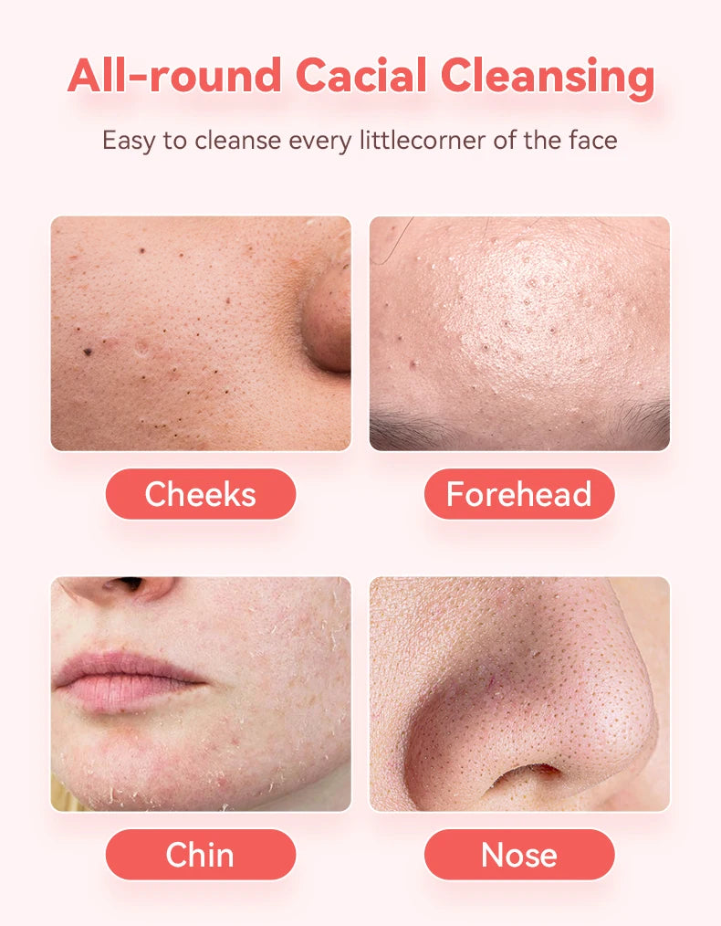 Ultrasonic Skin Scrubber Face Spatula – Deep Pore Cleaner, Blackhead Extractor & Gentle Facial Exfoliator