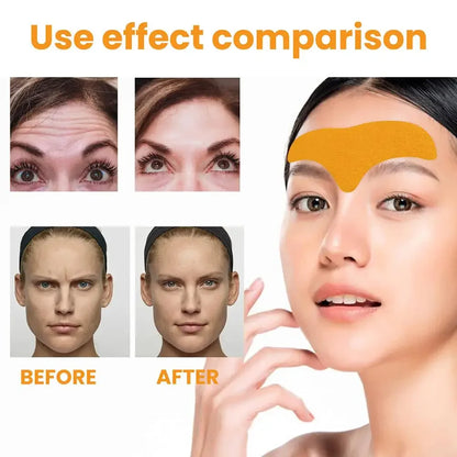 10-100pcs Forehead Wrinkle Patches – Anti-Wrinkle Gel Patches for Forehead Line Removal & Skin Care