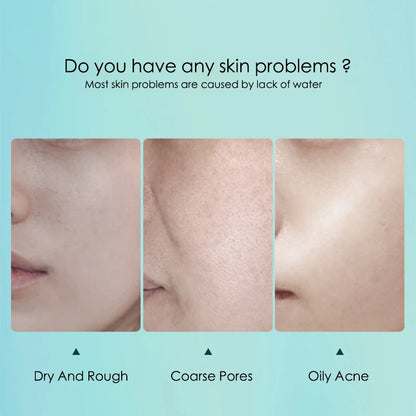 20pcs Hyaluronic Acid & Collagen Face Masks – Moisturizing, Firming, Hydrating Korean Skincare Sheet Masks