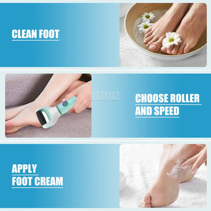 Wireless Electric Foot Grinder – Waterproof Callus Remover & Pedicure Tool for Dead, Hard, and Cracked Skin