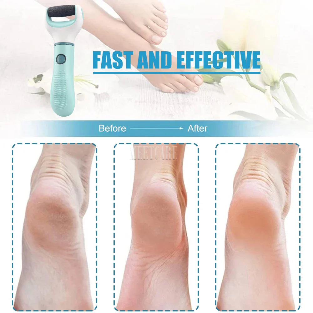Wireless Electric Foot Grinder – Waterproof Callus Remover & Pedicure Tool for Dead, Hard, and Cracked Skin