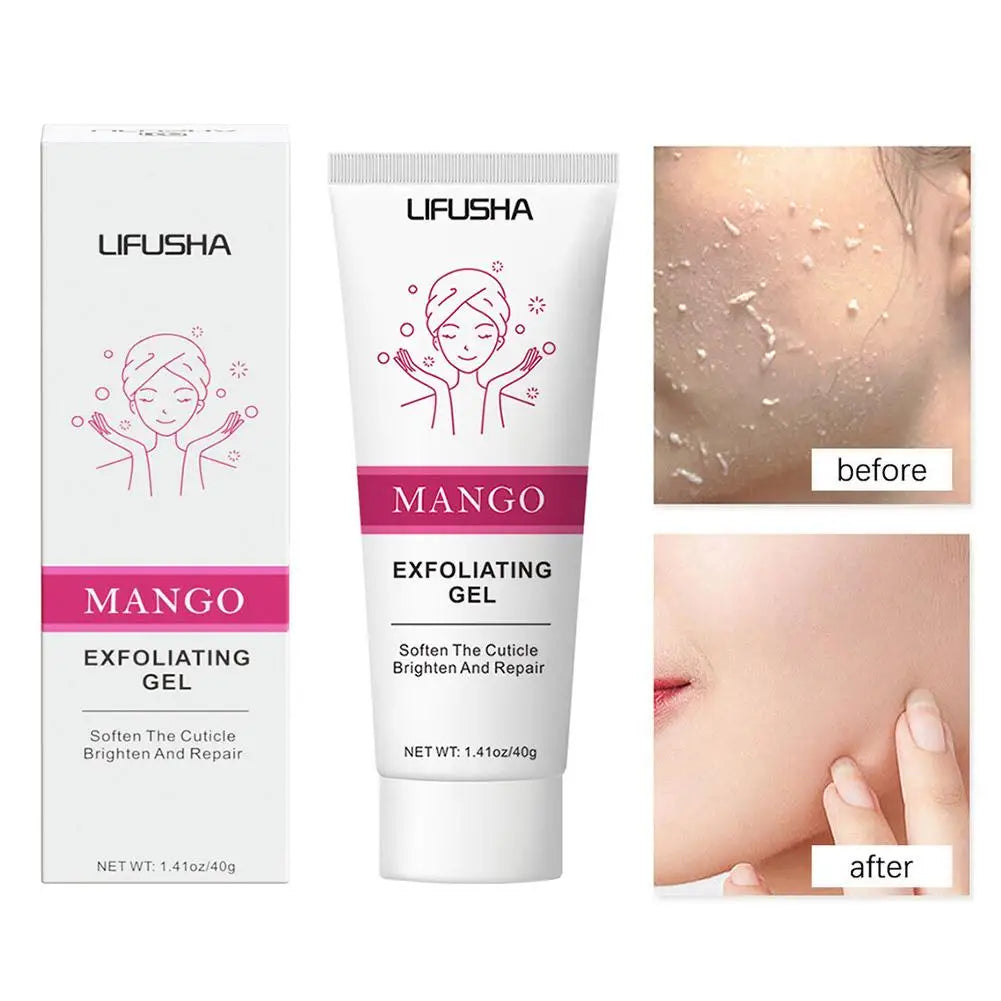 Aloe Vera Face Exfoliating Gel – Blackhead Remover, Pore Minimizer & Moisturizing Facial Scrub (30g–100g)