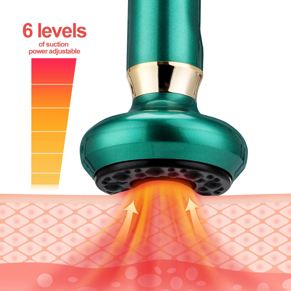 Electric Gua Sha Vacuum Massager – Anti-Cellulite Suction Cup with Infrared Heat Therapy for Slimming & Skin Rejuvenation