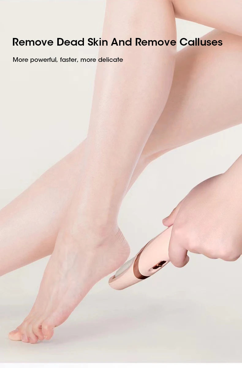 Electric Foot Grinder – Rechargeable Callus Remover & Pedicure Tool