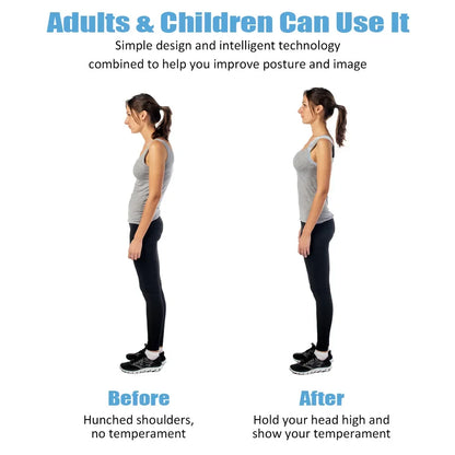 Smart Posture Corrector with Sensor – Invisible Back Support Belt & Hunchback Reminder for Adults and Kids