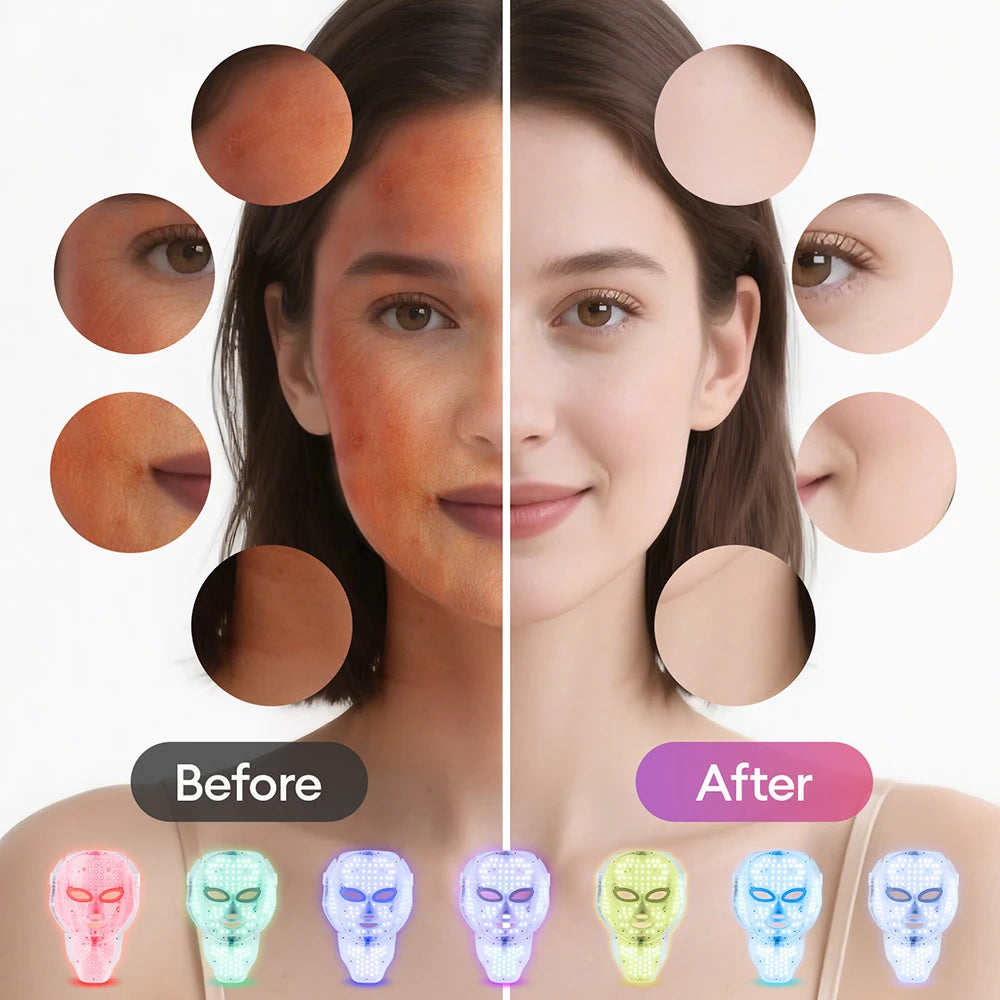 7-Color LED Face & Neck Light Therapy Mask – Electric Facial Skincare Mask with Remote Control